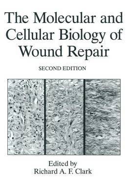 The Molecular and Cellular Biology of Wound Repair 1