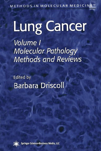 bokomslag Lung Cancer