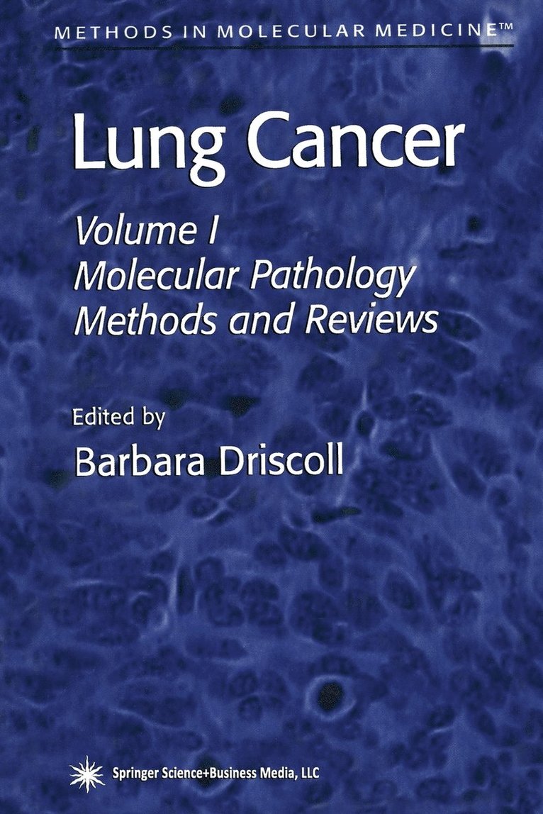 Barbara Driscoll - Lung Cancer, Häftad