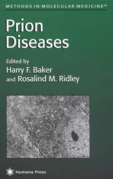 Harry F. Baker, Rosalind M. Ridley - Prion Diseases, Häftad