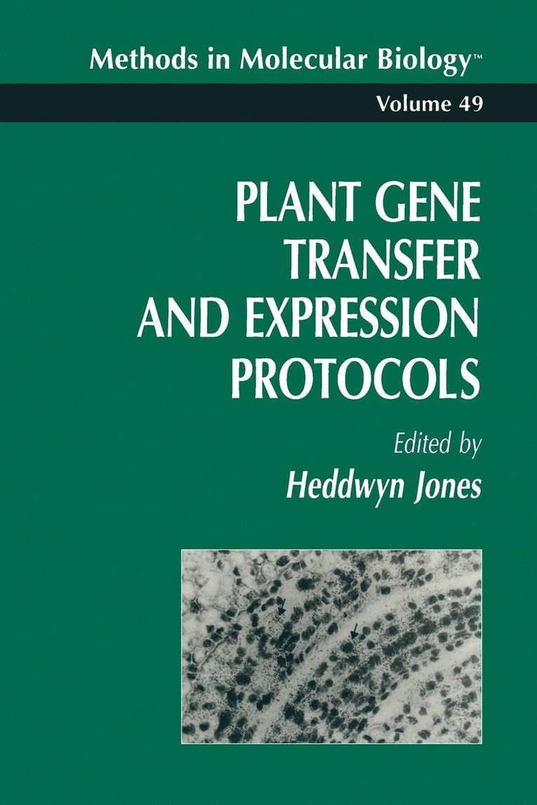 Plant Gene Transfer and Expression Protocols 1