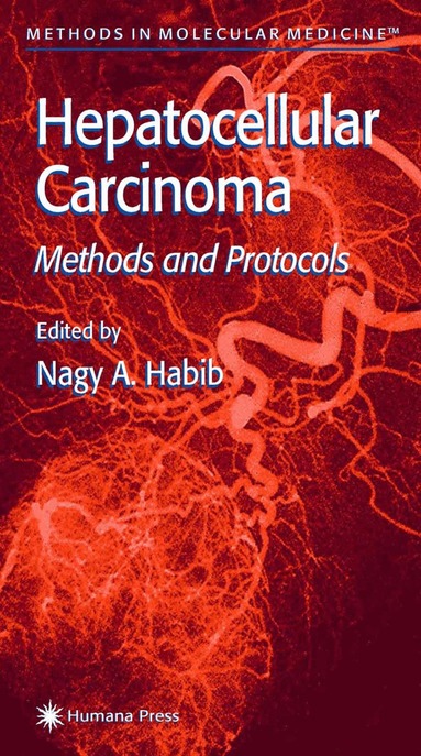 Nagy A. Habib - Hepatocellular Carcinoma, Häftad