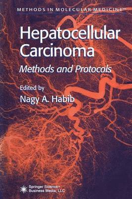 Hepatocellular Carcinoma 1