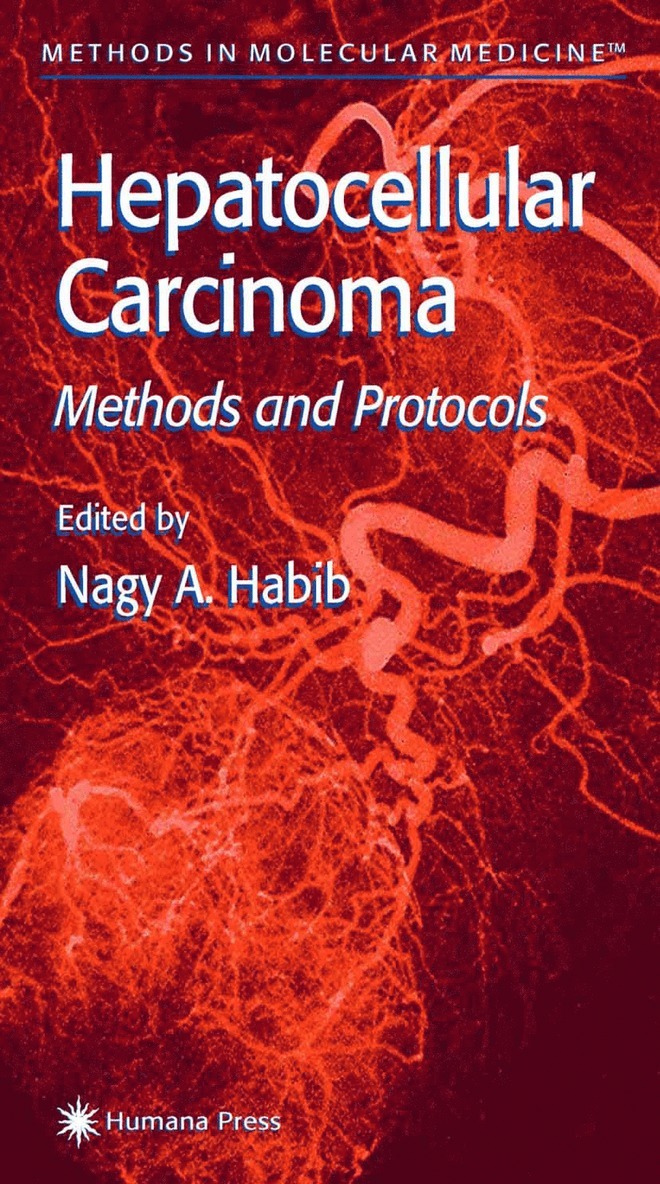 Nagy A. Habib - Hepatocellular Carcinoma, Häftad