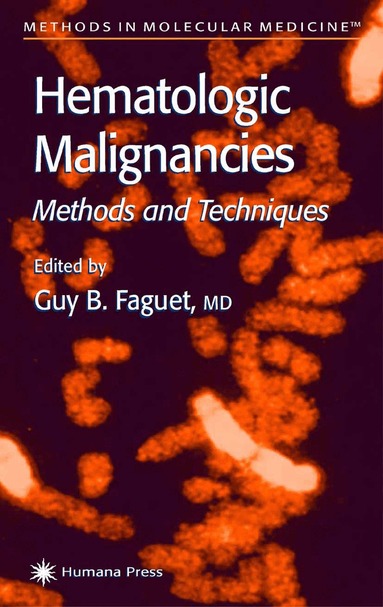 Guy B. Faguet - Hematologic Malignancies, Häftad