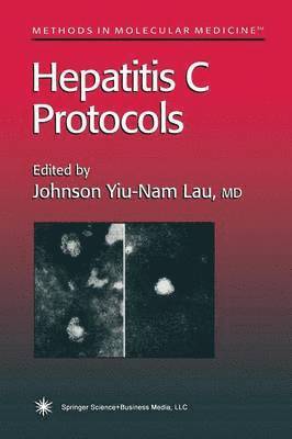 bokomslag Hepatitis C Protocols