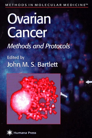 John M. S. Bartlett - Ovarian Cancer, Häftad