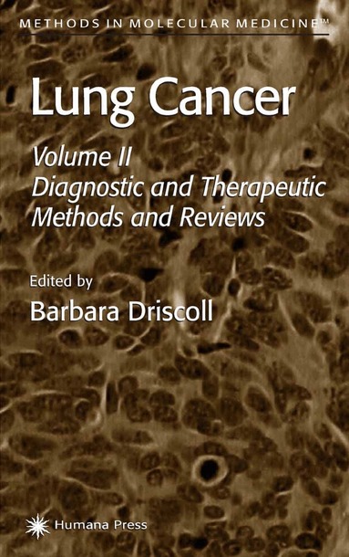 Barbara Driscoll - Lung Cancer, Häftad