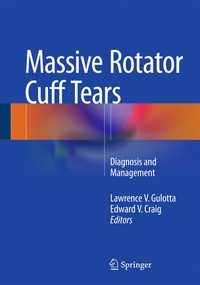 bokomslag Massive Rotator Cuff Tears