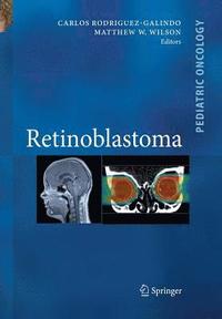 bokomslag Retinoblastoma