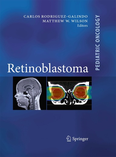 Carlos Rodriguez Galindo, Matthew W. Wilson - Retinoblastoma, Häftad