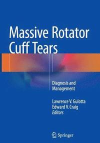 bokomslag Massive Rotator Cuff Tears