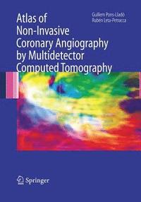 bokomslag Atlas of Non-Invasive Coronary Angiography by Multidetector Computed Tomography