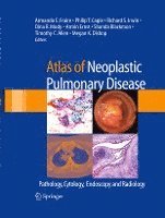 bokomslag Atlas of Neoplastic Pulmonary Disease