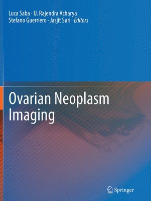Ovarian Neoplasm Imaging 1