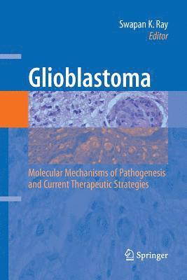 bokomslag Glioblastoma: