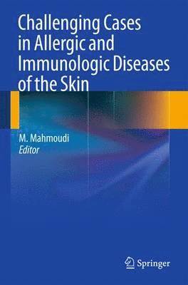 Challenging Cases in Allergic and Immunologic Diseases of the Skin 1