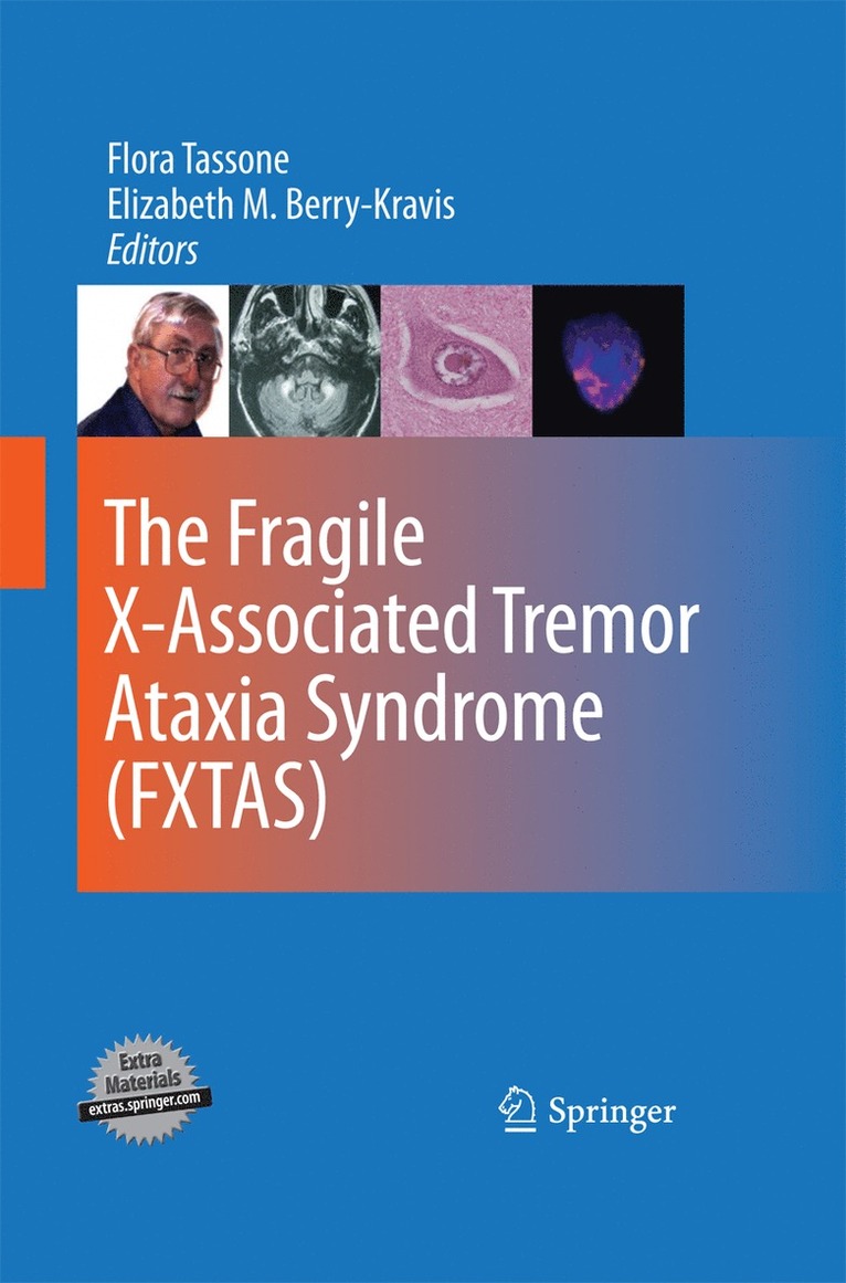 Fragile X-Associated Tremor Ataxia Syndrome (FXTAS)