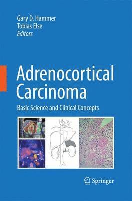 bokomslag Adrenocortical Carcinoma