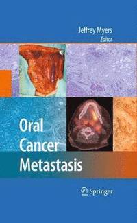 bokomslag Oral Cancer Metastasis