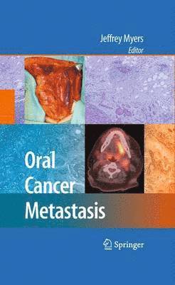 Jeffrey Myers - Oral Cancer Metastasis, Häftad