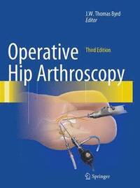 bokomslag Operative Hip Arthroscopy