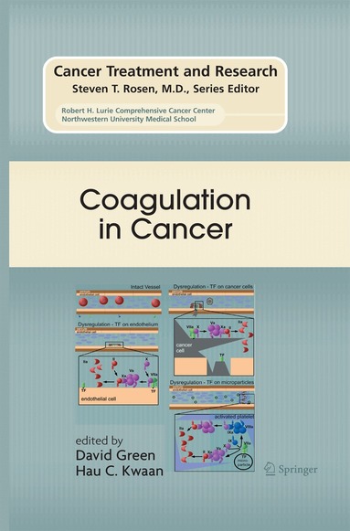 David Green, Hau C. Kwaan - Coagulation in Cancer, Häftad