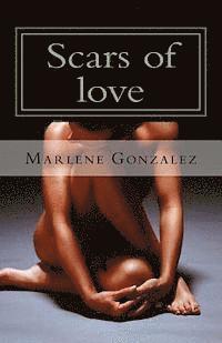 bokomslag Scars of love: Surviving in a world of pain