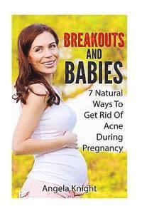 Breakouts And Babies: 7 Natural Ways To Get Rid Of Acne During Pregnancy 1