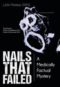 bokomslag Nails That Failed