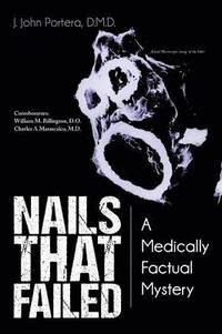 bokomslag Nails That Failed