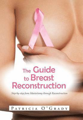 Patricia O'Grady - Guide to Breast Reconstruction, Inbunden