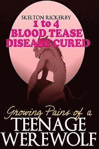 bokomslag Growing Pains of a Teenage Werewolf Books 1 to 4: Blood/Tease/Disease/Cured