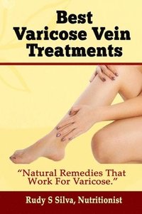 bokomslag Best Varicose Vein Treatments: Natural Remedies That Work for Varicose