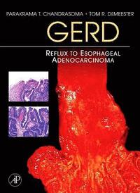 bokomslag Gerd: Reflux to Esophageal Adenocarcinoma