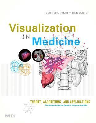 Bernhard Preim, Dirk Bartz - Visual Computing for Medicine: Theory, Algorithms, and Applications, Häftad