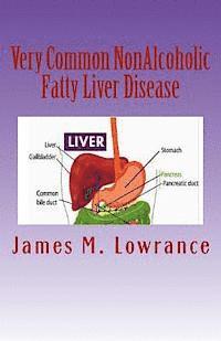 bokomslag Very Common NonAlcoholic Fatty Liver Disease: How To Know if You Have Hepatic Steatosis