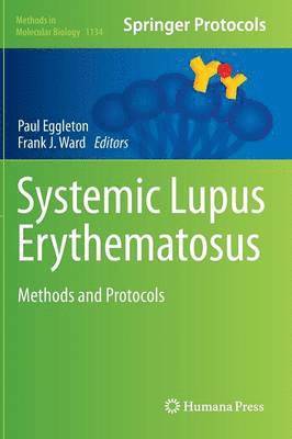 Systemic Lupus Erythematosus 1