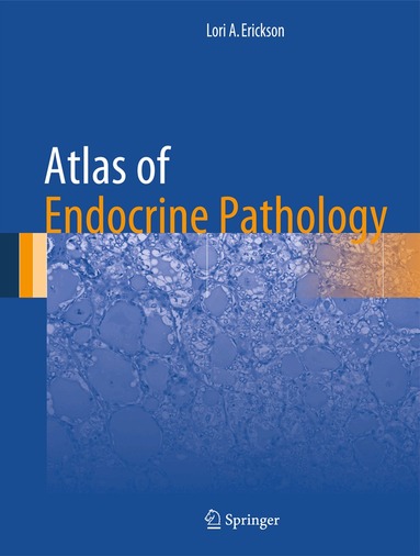 Lori A. Erickson - Atlas of Endocrine Pathology, Inbunden