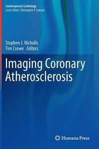 bokomslag Imaging Coronary Atherosclerosis