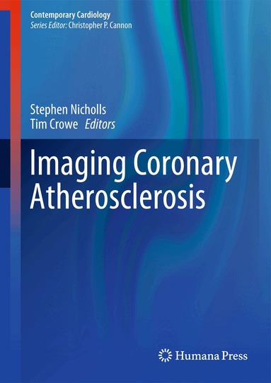Stephen J. Nicholls, Tim Crowe - Imaging Coronary Atherosclerosis, Inbunden