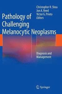 bokomslag Pathology of Challenging Melanocytic Neoplasms