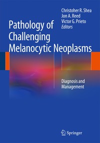 bokomslag Pathology of Challenging Melanocytic Neoplasms