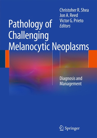 bokomslag Pathology of Challenging Melanocytic Neoplasms