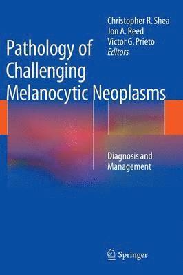 Christopher R. Shea, Jon A. Reed, Victor G. Prieto - Pathology of Challenging Melanocytic Neoplasms, Inbunden