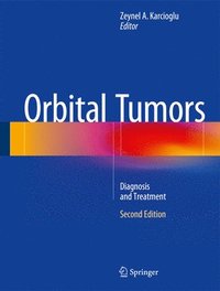 bokomslag Orbital Tumors