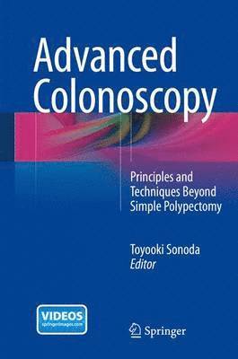 bokomslag Advanced Colonoscopy