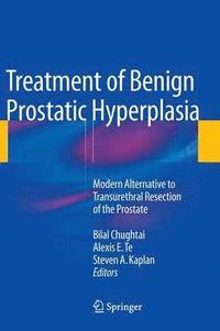 bokomslag Treatment of Benign Prostatic Hyperplasia: Modern Alternative to Transurethral Resection of the Prostate