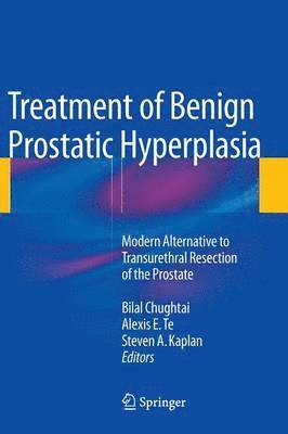 bokomslag Treatment of Benign Prostatic Hyperplasia: Modern Alternative to Transurethral Resection of the Prostate