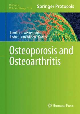 Osteoporosis and Osteoarthritis 1